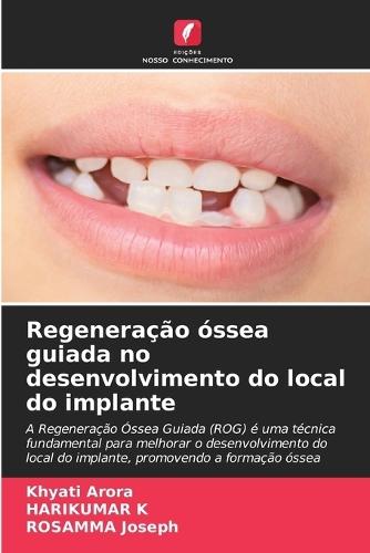 Regeneração óssea guiada no desenvolvimento do local do implante