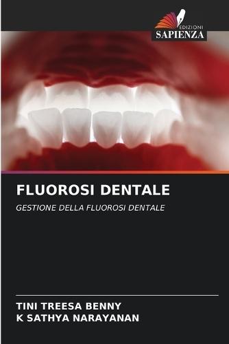 Fluorosi Dentale