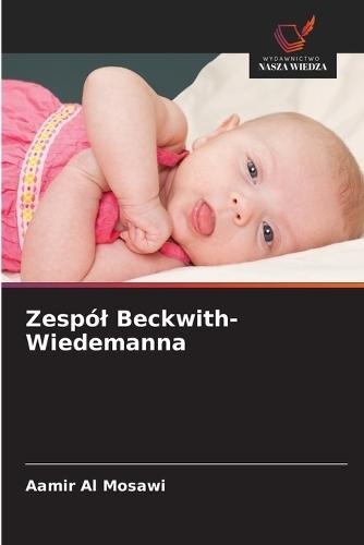 Zespól Beckwith-Wiedemanna