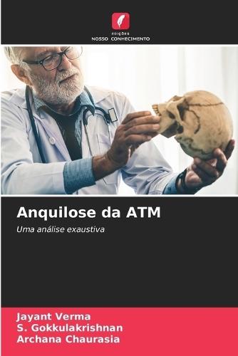 Anquilose da ATM