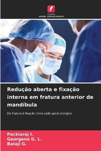 Redução aberta e fixação interna em fratura anterior de mandíbula