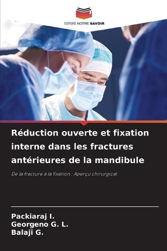 Réduction ouverte et fixation interne dans les fractures antérieures de la mandibule