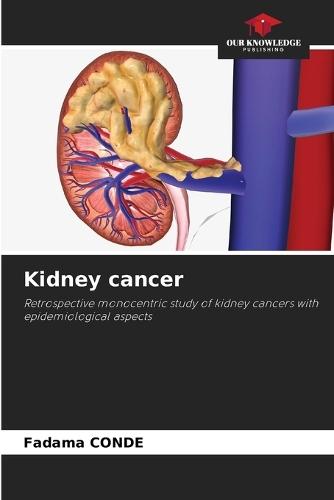 Kidney cancer