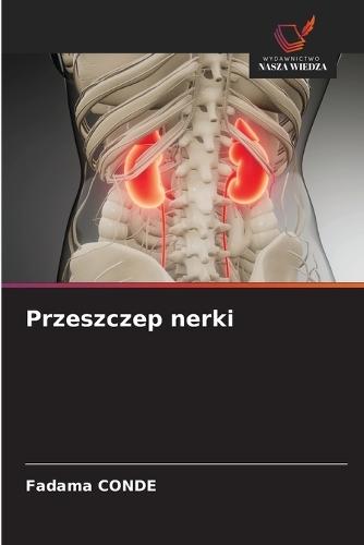 Przeszczep nerki