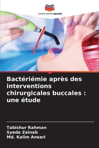 Bactériémie après des interventions chirurgicales buccales: une étude