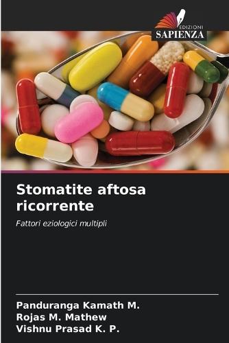 Stomatite aftosa ricorrente