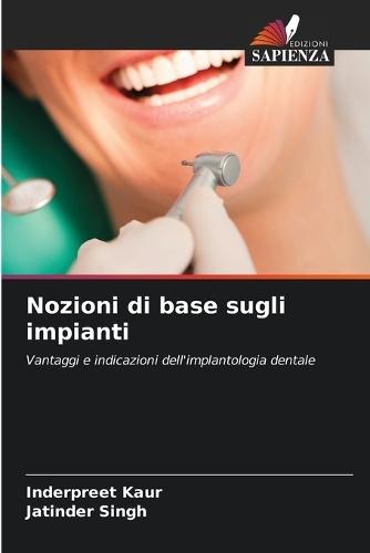 Nozioni di base sugli impianti