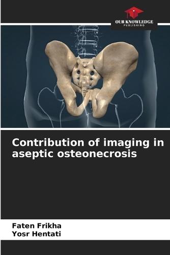 Contribution of imaging in aseptic osteonecrosis