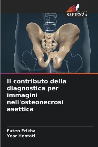 Il contributo della diagnostica per immagini nell'osteonecrosi asettica