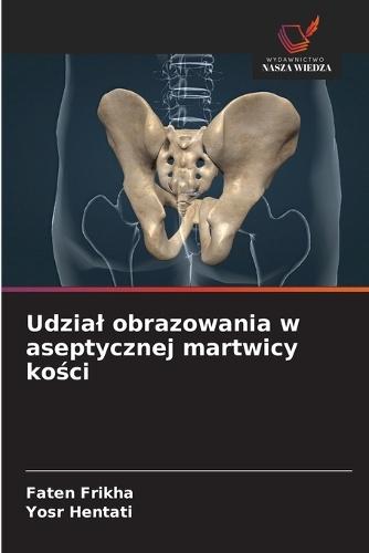 Udzial obrazowania w aseptycznej martwicy kości