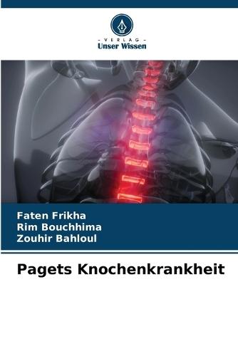 Pagets Knochenkrankheit