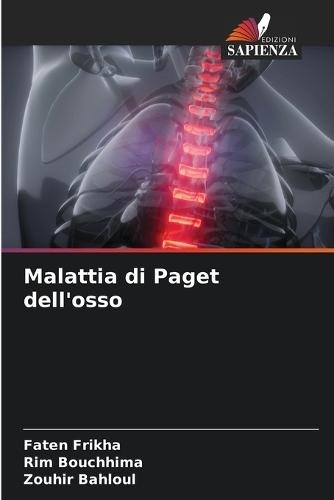 Malattia di Paget dell'osso