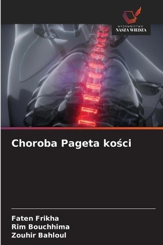 Choroba Pageta kości