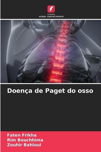 Doença de Paget do osso