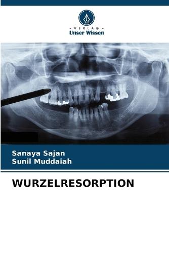 Wurzelresorption