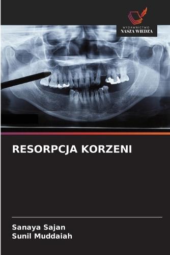 Resorpcja Korzeni