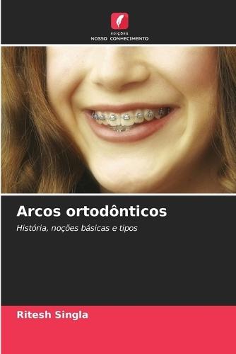 Arcos ortodônticos