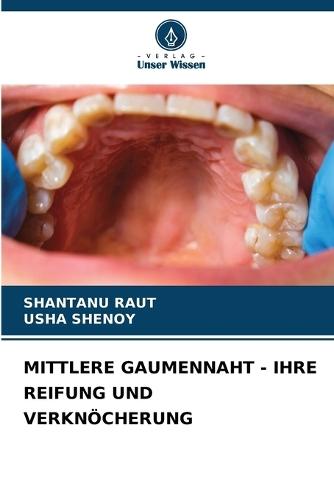 Mittlere Gaumennaht - Ihre Reifung Und Verknöcherung