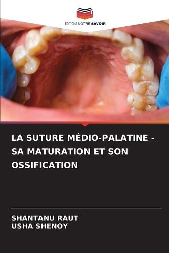 La Suture Médio-Palatine - Sa Maturation Et Son Ossification