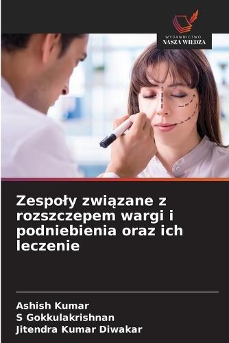 Zespoly związane z rozszczepem wargi i podniebienia oraz ich leczenie
