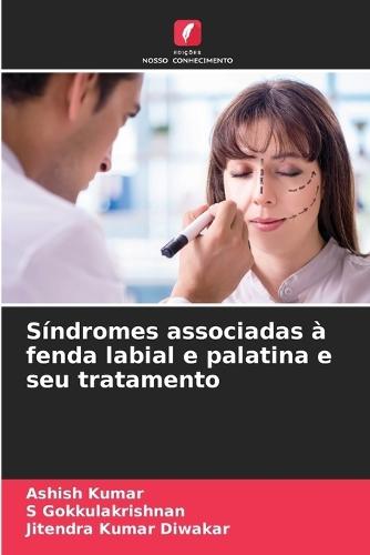 Síndromes associadas à fenda labial e palatina e seu tratamento