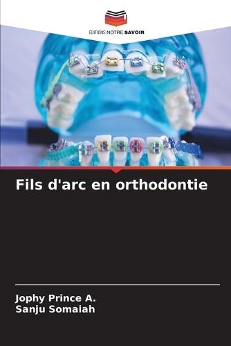 Fils d'arc en orthodontie