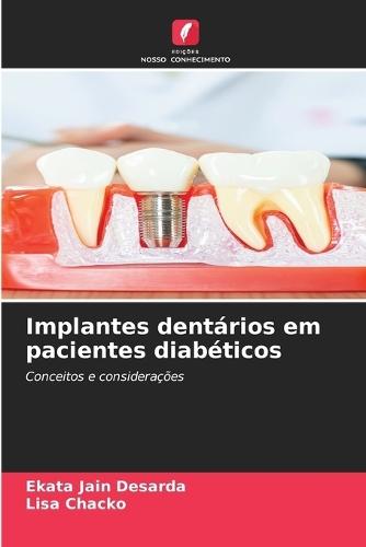 Implantes dentários em pacientes diabéticos