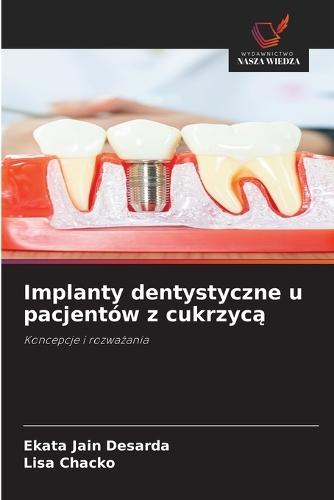 Implanty dentystyczne u pacjentów z cukrzycą