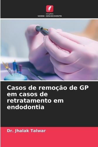 Casos de remoção de GP em casos de retratamento em endodontia