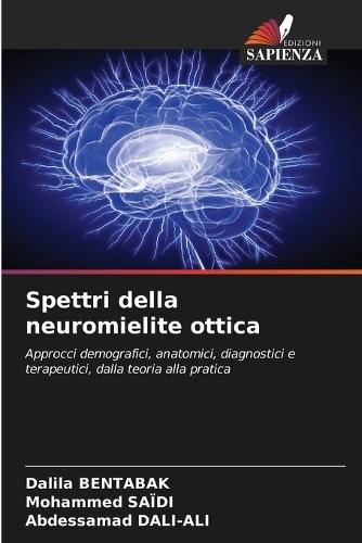 Spettri della neuromielite ottica