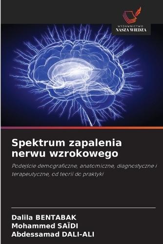 Spektrum zapalenia nerwu wzrokowego