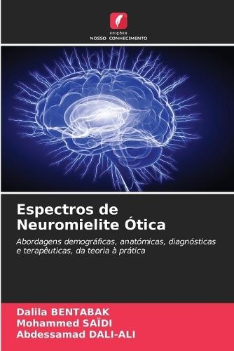 Espectros de Neuromielite Ótica