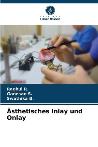 Ästhetisches Inlay und Onlay