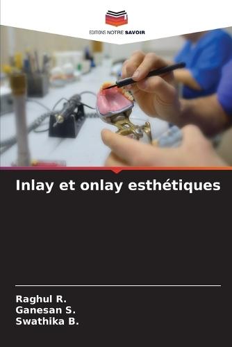Inlay et onlay esthétiques
