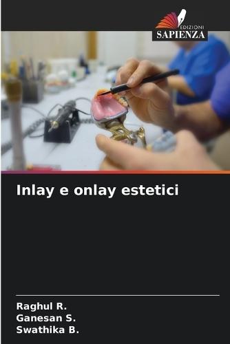 Inlay e onlay estetici