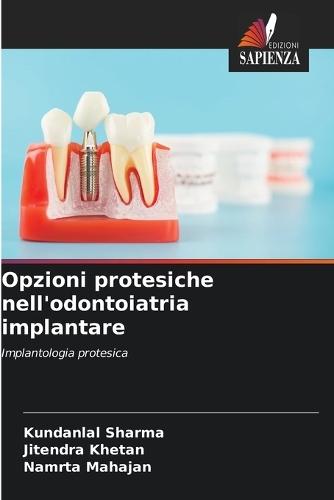 Opzioni protesiche nell'odontoiatria implantare