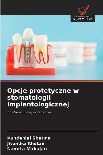 Opcje protetyczne w stomatologii implantologicznej