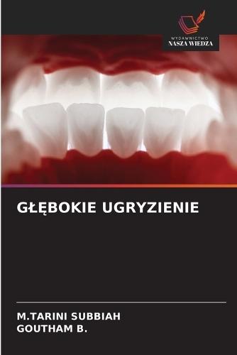 GlĘbokie Ugryzienie