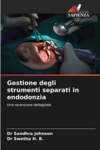 Gestione degli strumenti separati in endodonzia