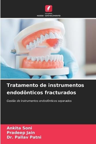 Tratamento de instrumentos endodônticos fracturados