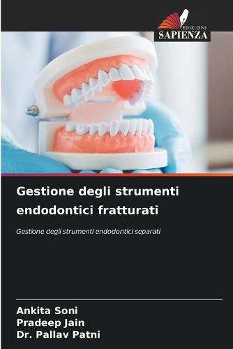 Gestione degli strumenti endodontici fratturati
