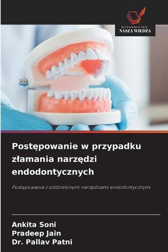 Postępowanie w przypadku zlamania narzędzi endodontycznych