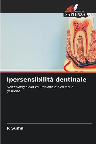 Ipersensibilità dentinale