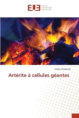 Artérite à cellules géantes
