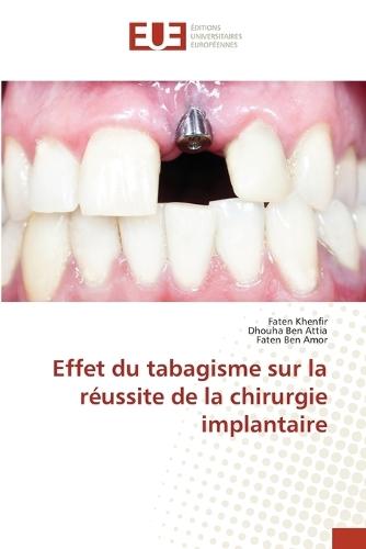 Effet du tabagisme sur la réussite de la chirurgie implantaire