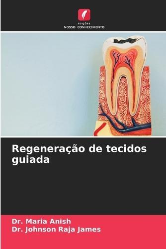 Regeneração de tecidos guiada