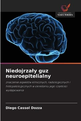 Niedojrzaly guz neuroepitelialny