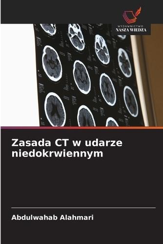 Zasada CT w udarze niedokrwiennym