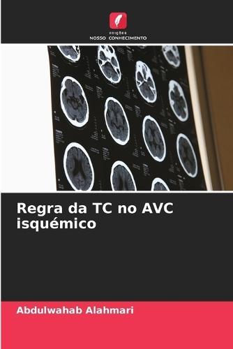 Regra da TC no AVC isquémico