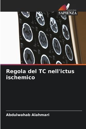 Regola del TC nell'ictus ischemico